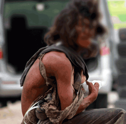 Diduga Penggunaan Anggaran ODMK Dinkes Kab. Sukabumi Thn 2023 bermasalah 1 baju orang gila 38