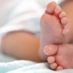 ilustrasi bayi achondroplasia 1 169