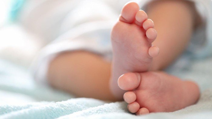 Bongkar Sindikat Penjualan Bayi ke Singapura, Polda Jabar Selamatkan Enam Bayi dan Tahan 12 Pelaku 1 ilustrasi bayi achondroplasia 1 169